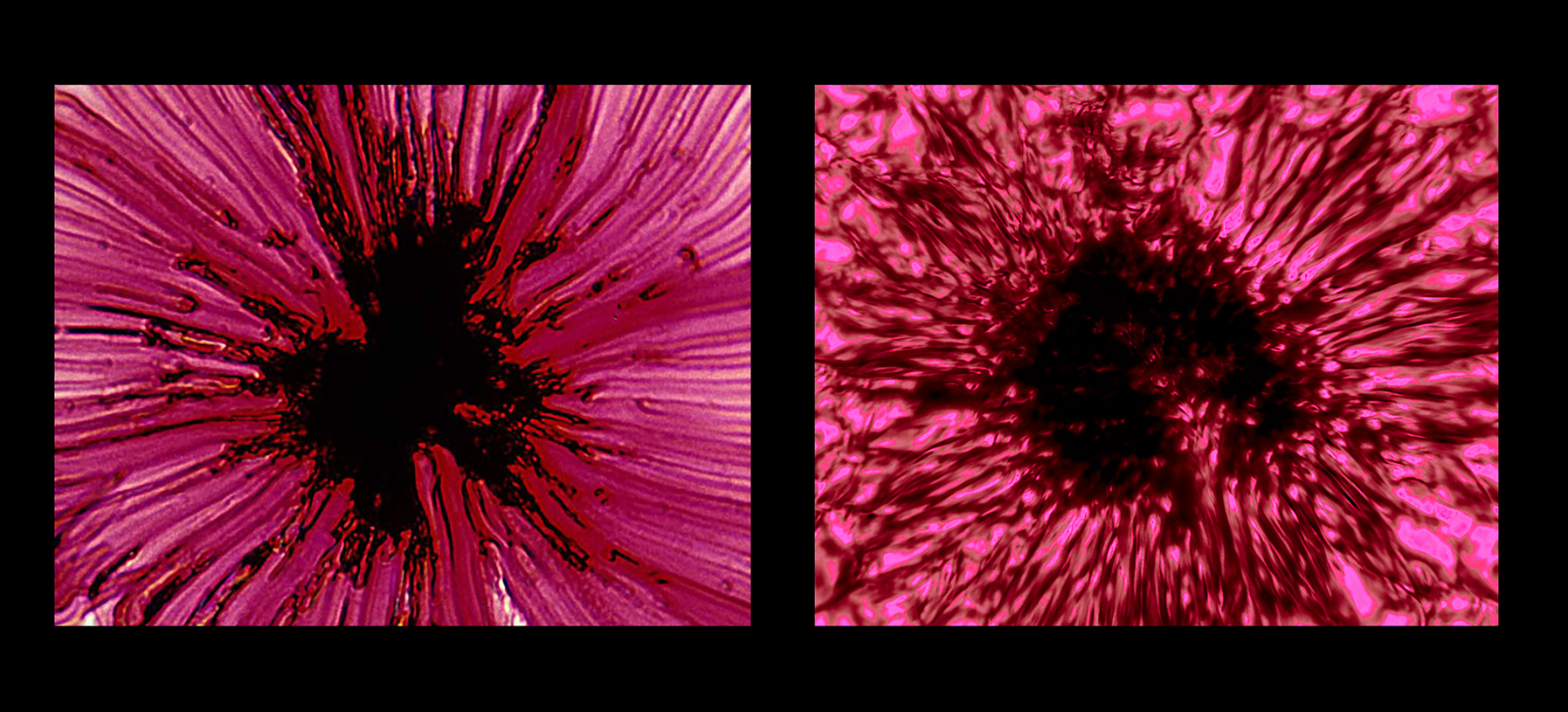 Shrubby Plant Hair  vs.  Sunspot