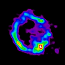 Chandra E0102-72.3 X-ray Image