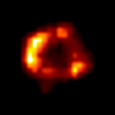 SN1987A, X-ray